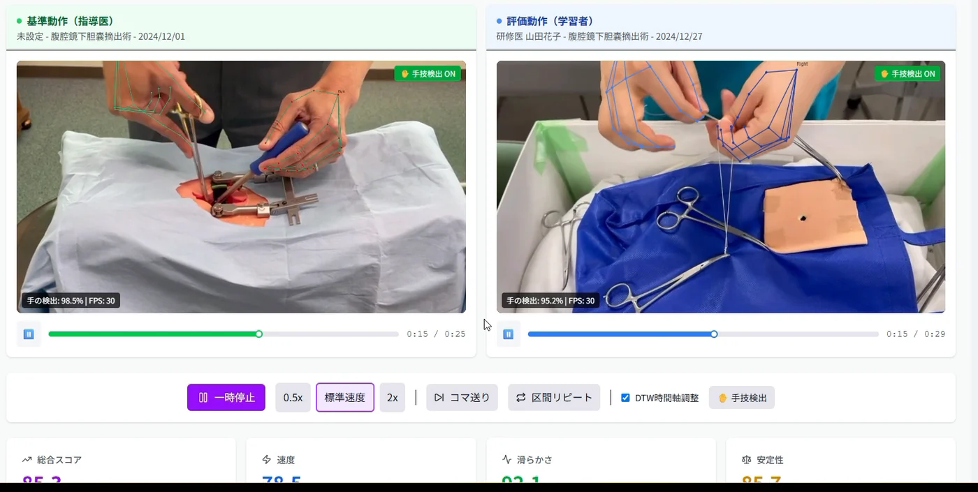 MindMotionAI の採点比較画面。指導医と学習者の手技を並べ、骨格検出のオーバーレイとスコアを表示